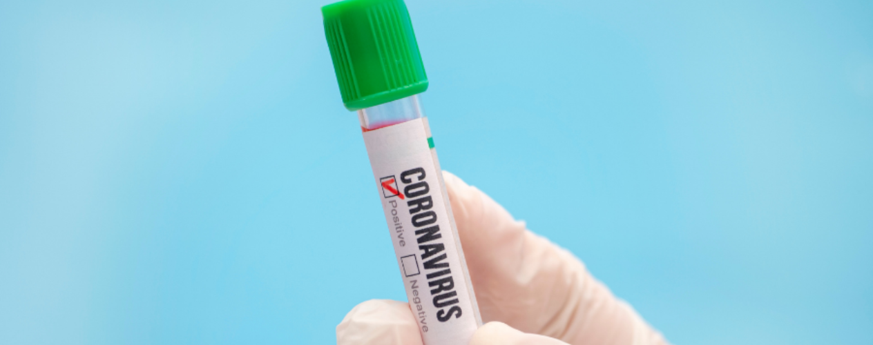 Test tube labeled "Coronavirus" with the positive box checked