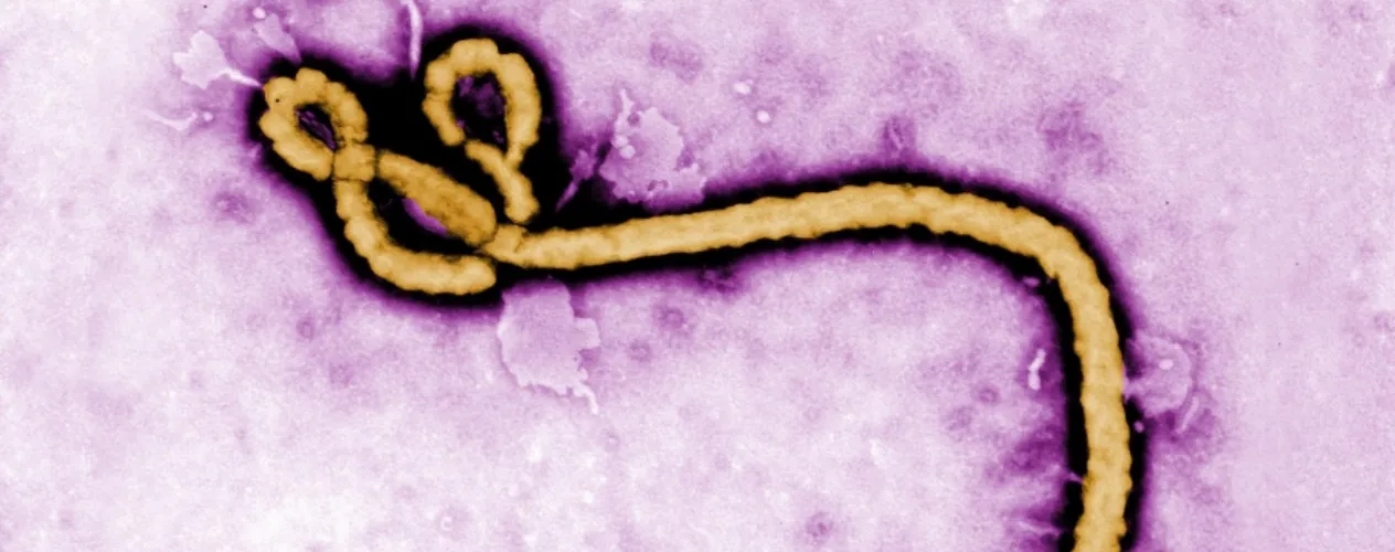 ebola