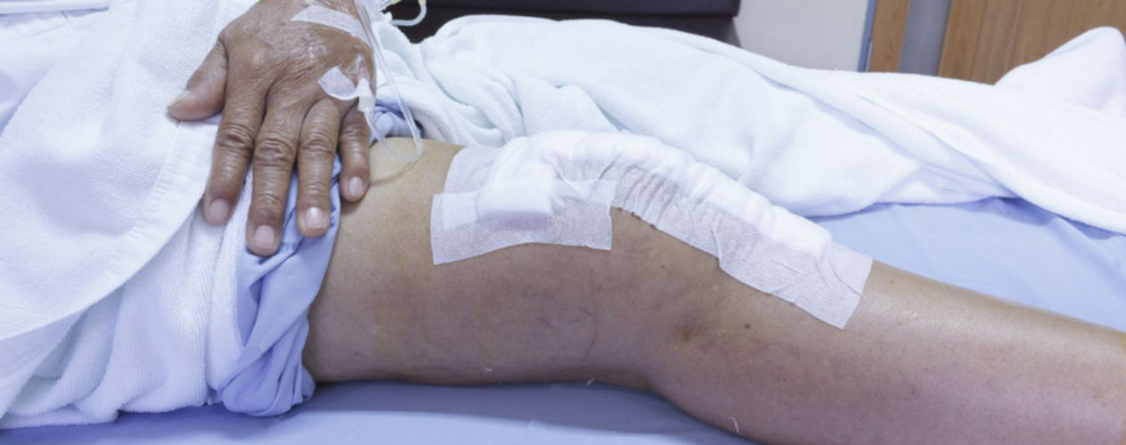 knee surgery patient on hospital bed