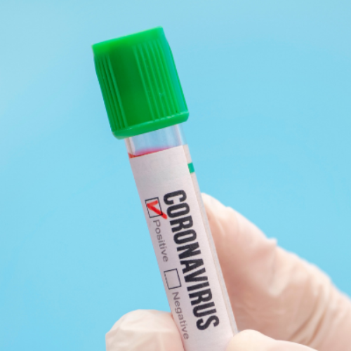Test tube labeled "Coronavirus" with the positive box checked
