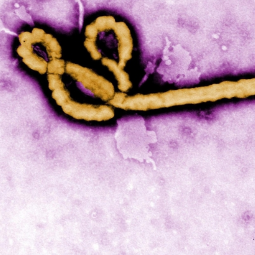 ebola