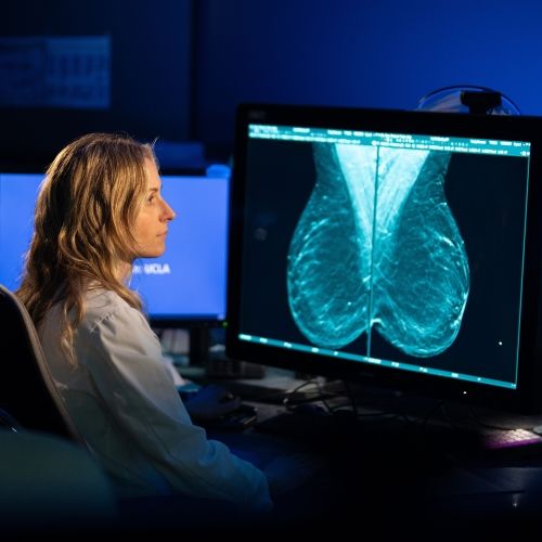 UCLA to lead $16 million national study on artificial intelligence in breast cancer screening