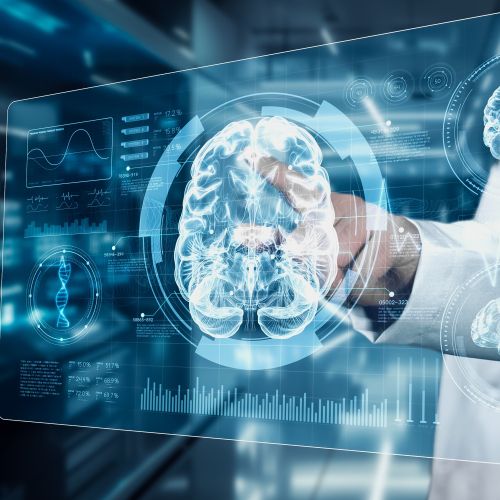 UCLA receives $25 million grant to advance AI-centered research for Alzheimer’s and dementia patients