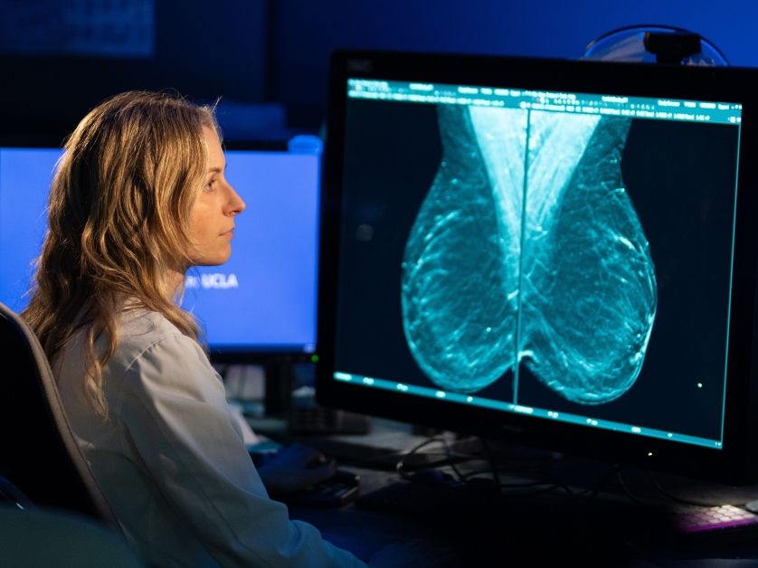 UCLA to lead $16 million national study on artificial intelligence in breast cancer screening